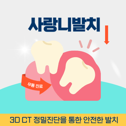 평택치과 평택시 치과 사랑니 발치